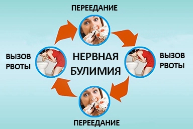 Лечение булимии в Глазове
